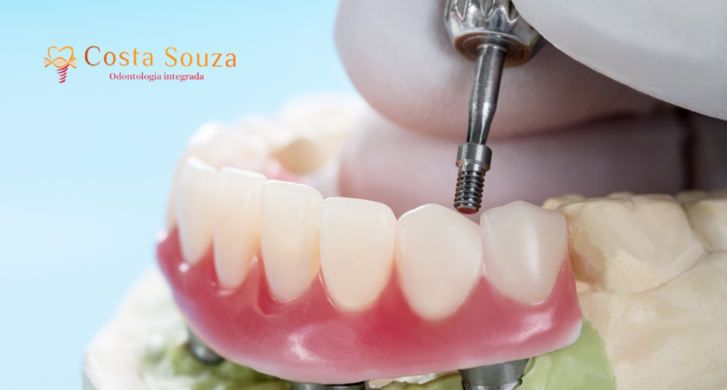 principais tipo de implantes